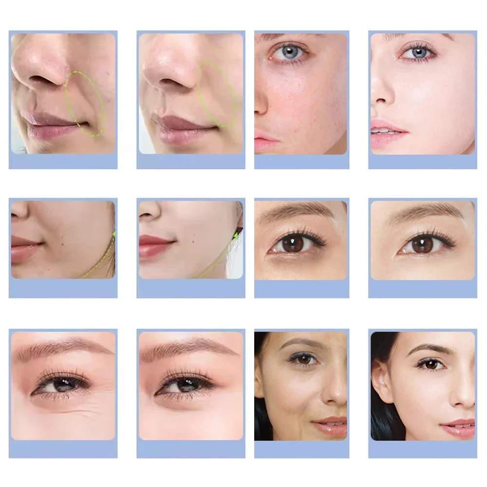 7 Types Facial CO2 Oxygen Bubb - Health Wellness Massage 评论和价格
